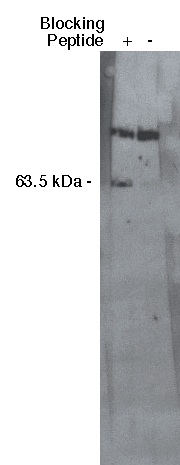 "
Western blot analysis using S1P lyase 1 antibody at a dilution of 1:400 on MDBK cell lysate (Cat. No. X1007) using Exalpha's mouse anti-rabbit HRP secondary antibody (Cat. No. X1207M) at 1:75,000."
